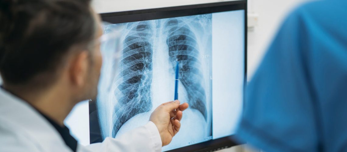 Ce qu’il faut savoir sur la fibroscopie pulmonaire ou bronchique