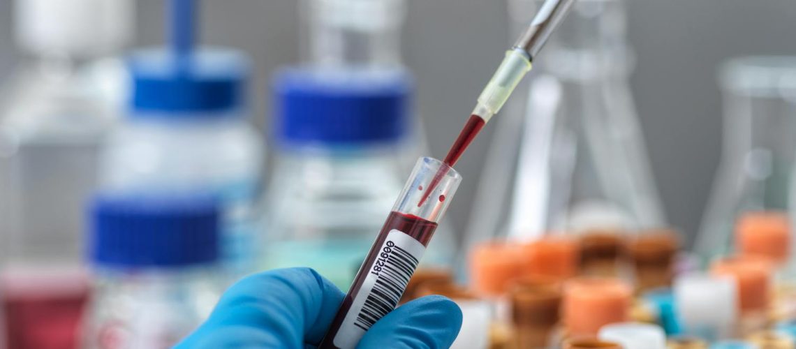 Immunoglobulines G (IgG) : définition, rôle, dosage Immunoglobulines G (IgG) : définition, rôle, dosage